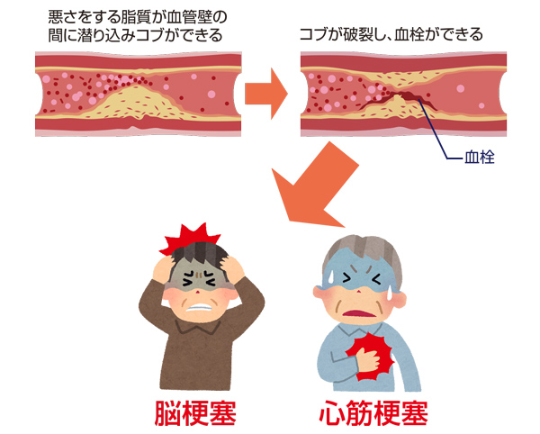 桶の理論 - 新百合ヶ丘 パーソナルトレーニング アクトライズのホームページ