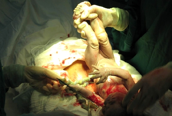 出産のイラストかわいいフリー素材集 いらすとや