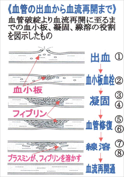 5,800点を超える血栓のイラスト素材、ロイヤリティフリーのベクター素材グラフィックスとクリップアート - iStock血管, 血小板, 心臓
