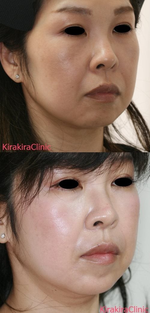 顔の「歪み」の原因とは？セルフでできる8つの改善法美的.com