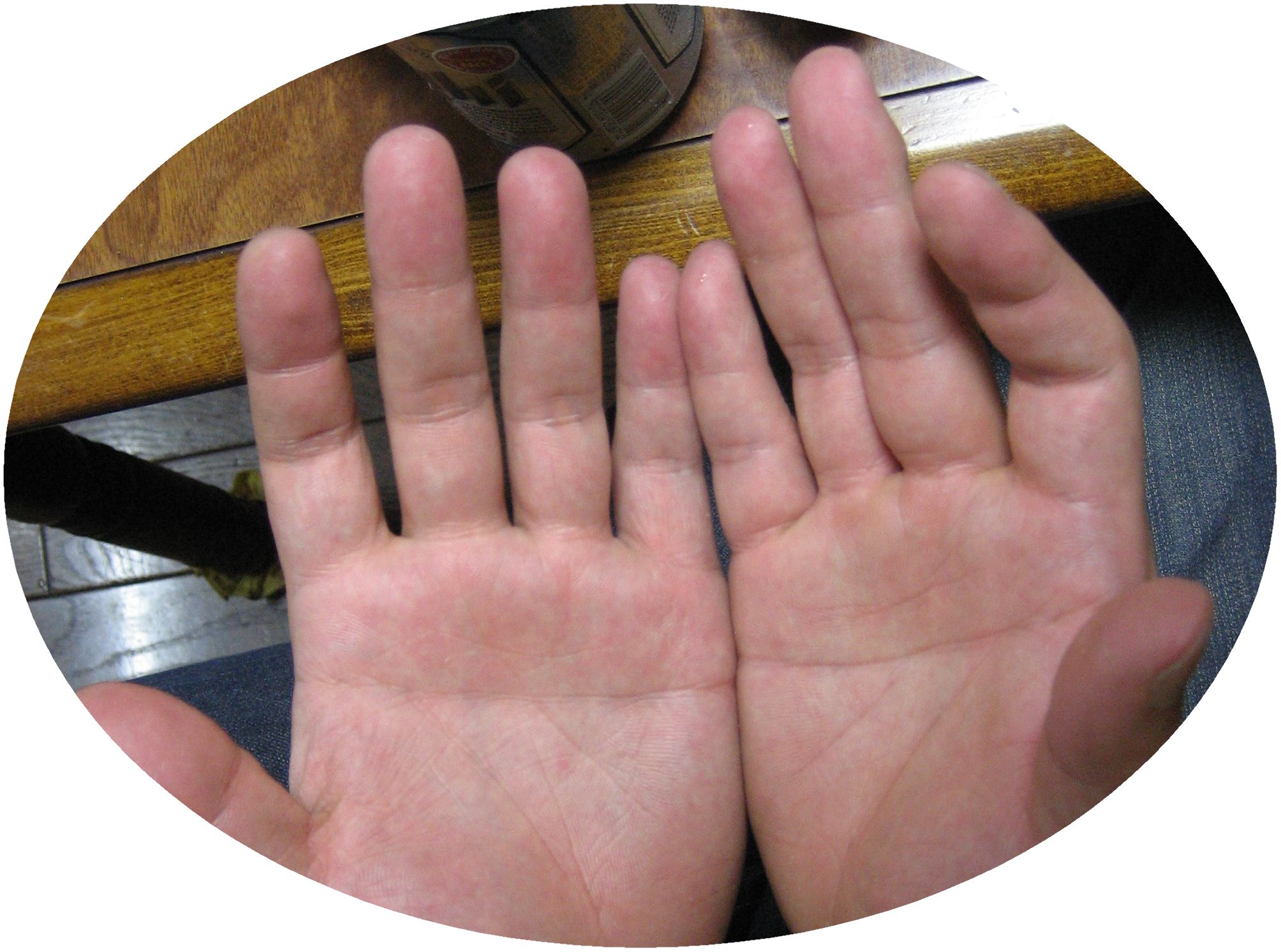 ますかけ線とは？左右の違いや他の手相との組み合わせも解説日本占い師協会 JFTA