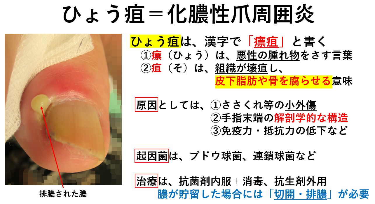 感染性腸炎市民のみなさまへ日本大腸肛門病学会