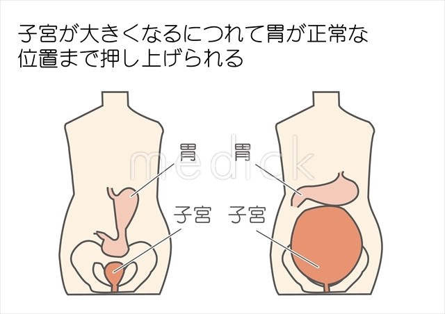 胃下垂？ -胃下垂 なんでしょうか？ でも痩せてないし便秘でもない-OKWAVE