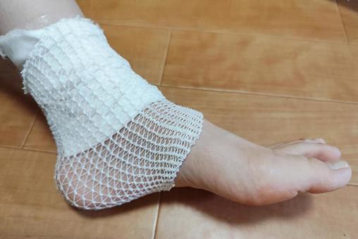 虫刺されの腫れがひどい！腫れが収まらない時の薬や対処法を解説