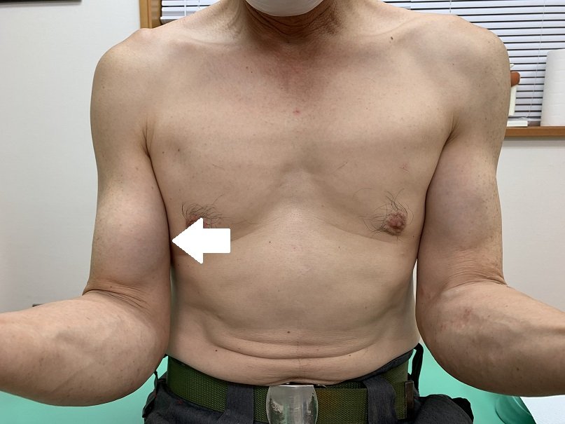 上腕二頭筋!!!簡単トレーニングで男らしい力こぶをつくる！ - ハピネス