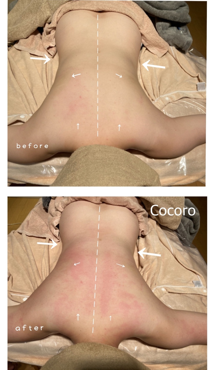 背中スッキリ！で若返るかも？自分でもできる背中のリンパマッサージ