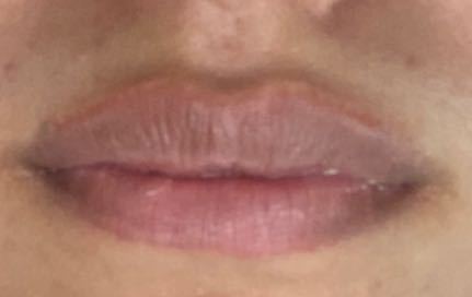 唇の色が悪いのはなぜ？生まれつきや血色不良、黒ずみといった原因やリップケア方法について徹底解説！名古屋の美容外科・美容皮膚科ならCinderella & Da Vinci Clinic 公式