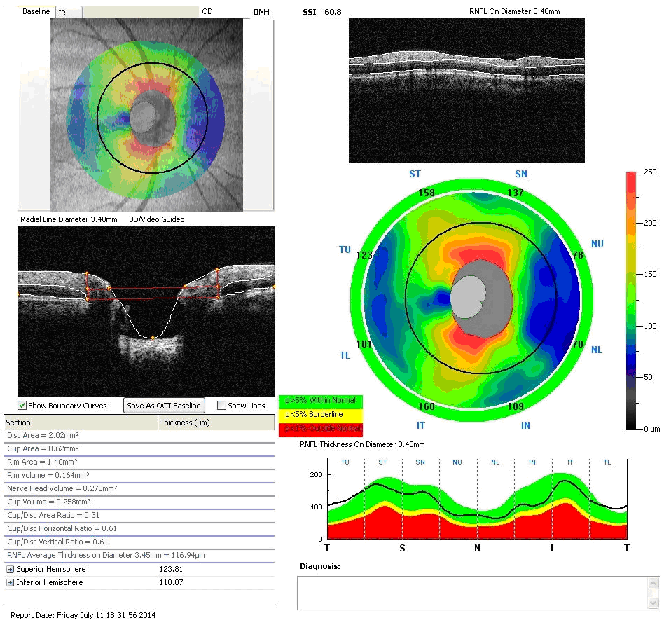 目の病気の早期発見のためには眼底検査が大切です。日本眼科医会からのお知らせ公益社団法人 日本眼科医会