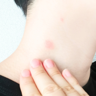 ブヨに刺された・「ていじん」の軽バンに自転車積んでキャンプで遊ぼう