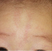 赤ちゃんのあざつだ小児科クリニック世田谷区 小児科一般・アレルギー科・乳幼児健診・予防接種