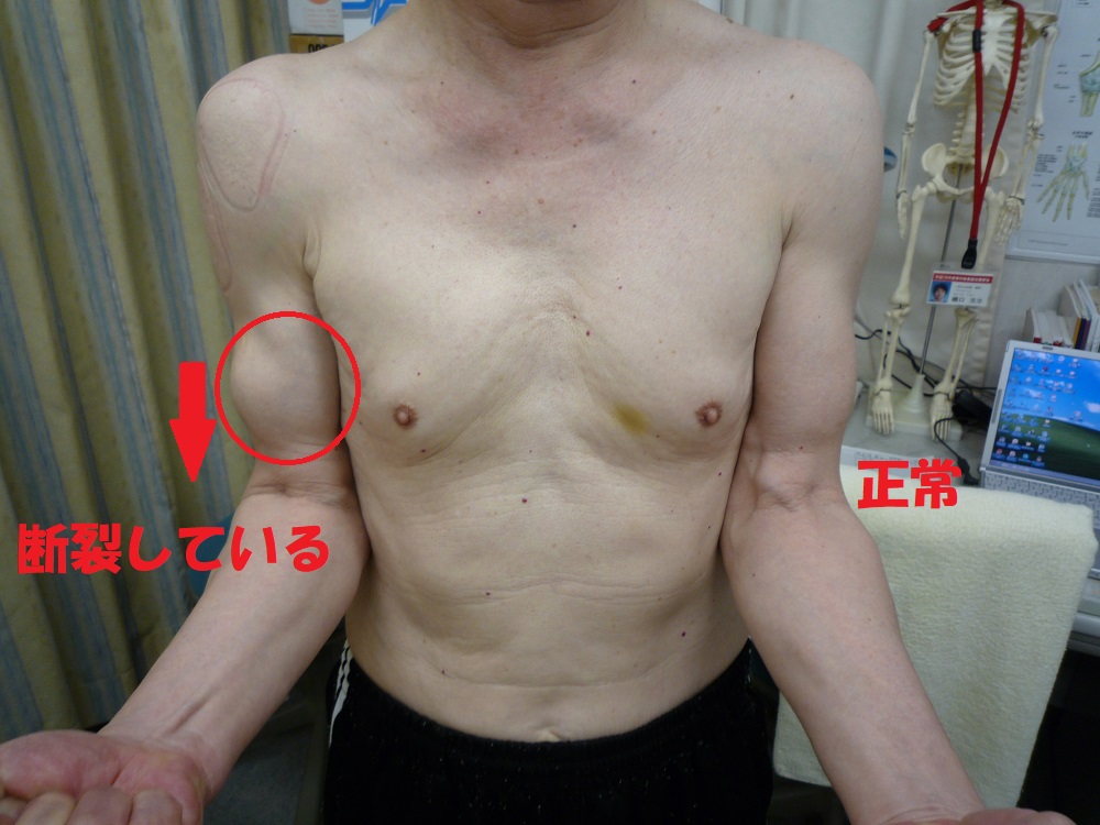 プロが教える 腕の筋肉を強化するための効果的なトレーニングとは - NASマガジン