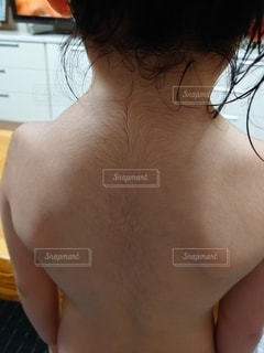 太ももの医療脱毛 - ドクター松井クリニック