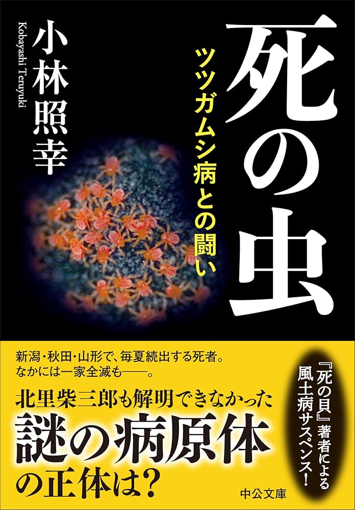 つつが虫病にご注意！！山形県