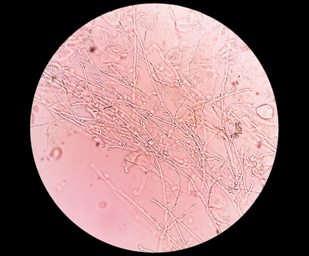 顕微鏡、 専門的な爪折りキャピラリー微小循環 USB HD デジタル顕微鏡血液微小循環 + 7 