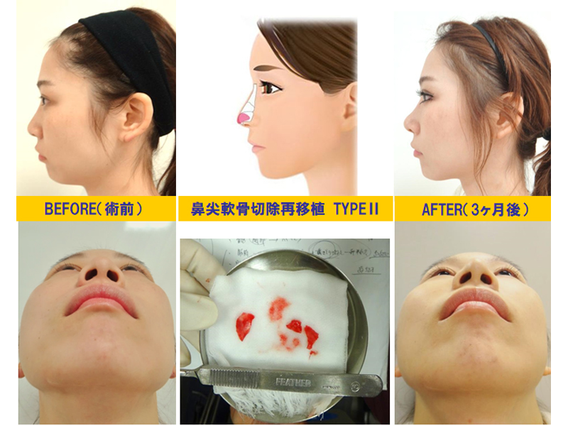 30万件突破！美容整形・美容外科の症例写真を探す湘南美容クリニック 公式