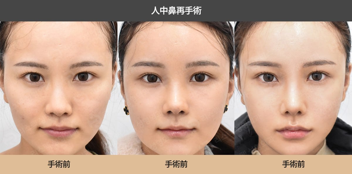 症例 顔が曲がって見える柏市の歯医者 ウィズ歯科クリニック 柏