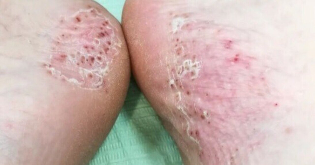 カラーアトラス 皮膚症状110症例でみる内科疾患 電子版付き出光俊郎, 出光俊郎 本通販Amazon