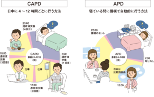 透析を止めた日』の作家・堀川惠子×医師・森建文 進化した腹膜透析。「東日本大震災では避難所や自宅で腹膜透析をした人も。災害時に強くセルフケアできるので高齢者に向いている」 婦人公論.jp- Yahoo!ニュース