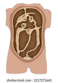 人工透析を受けている方や慢性腎臓病 CKD の歯科治療についてたんぽぽ歯科・矯正歯科小倉南区下曽根の歯医者