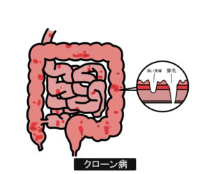 東京離島の皆さんと考える。自然資源を活用した「八方よし」のローカルツーリズムritokei 離島経済新聞
