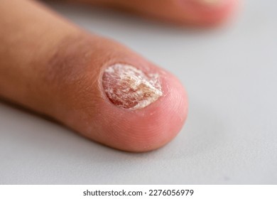 爪の中の黒い汚れ顕微鏡TikTok