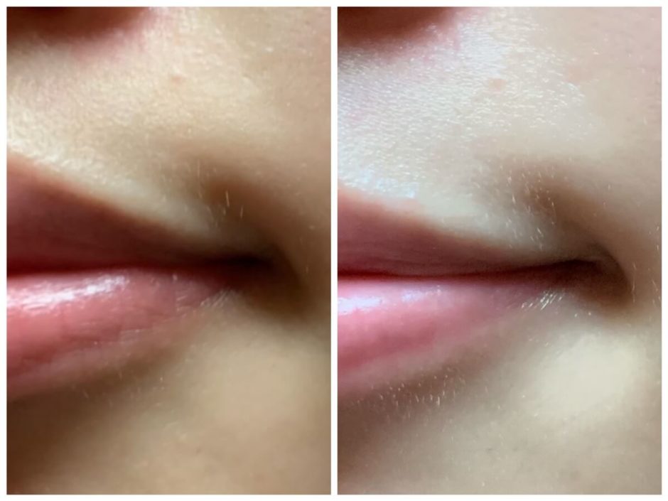 医師監修 青ヒゲの原因と対策！隠し方、治し方などをご紹介！Midashinami 身だしなみ