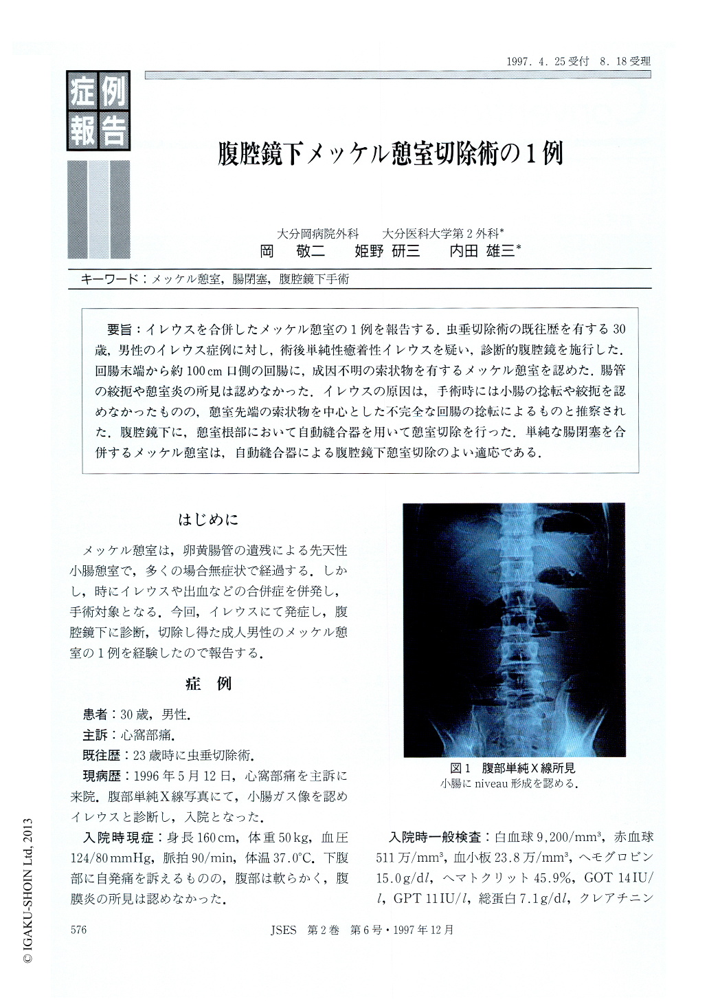 メッケル Meckel 憩室とは？症状や治療法のまとめ