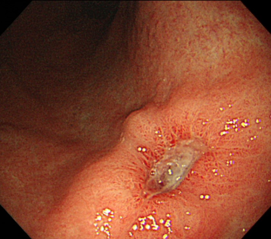 十二指腸虫 là gì? Cách đọc, phiên âm & nghĩa của từ 十二指腸虫