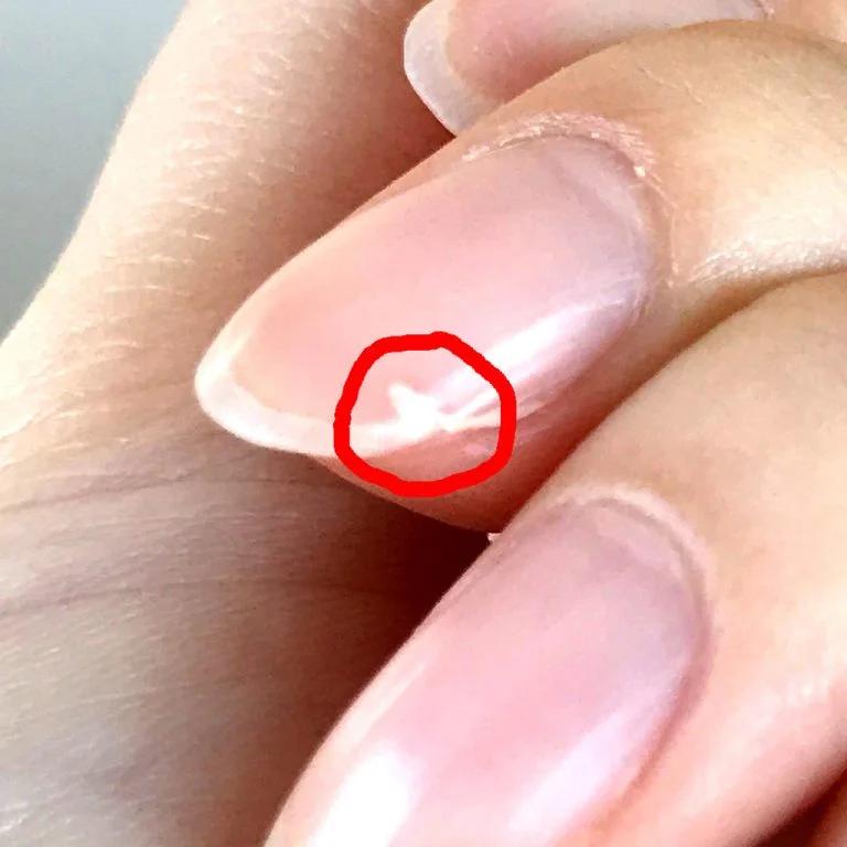 あかぎれフィルム製品情報救急絆創膏の阿蘇製薬株式会社