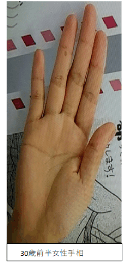 わたしの手相は両手共に離れ型。 両方の手が離れ型の人はわりと珍しいそうです。変わり者で人と同じ事をするのが嫌いでちょっと不思議な人というイメージを持たれるよう。独特なセンスを持ち、リーダーになれる気質を持っていて、カリスマ性があるとも。 占いをしている