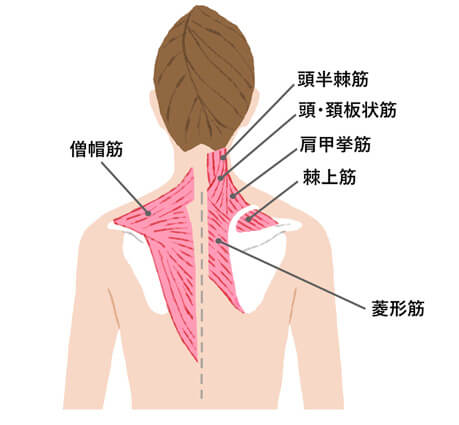 慢性的な肩こり肩こり・腰痛原因チェックエーザイ株式会社