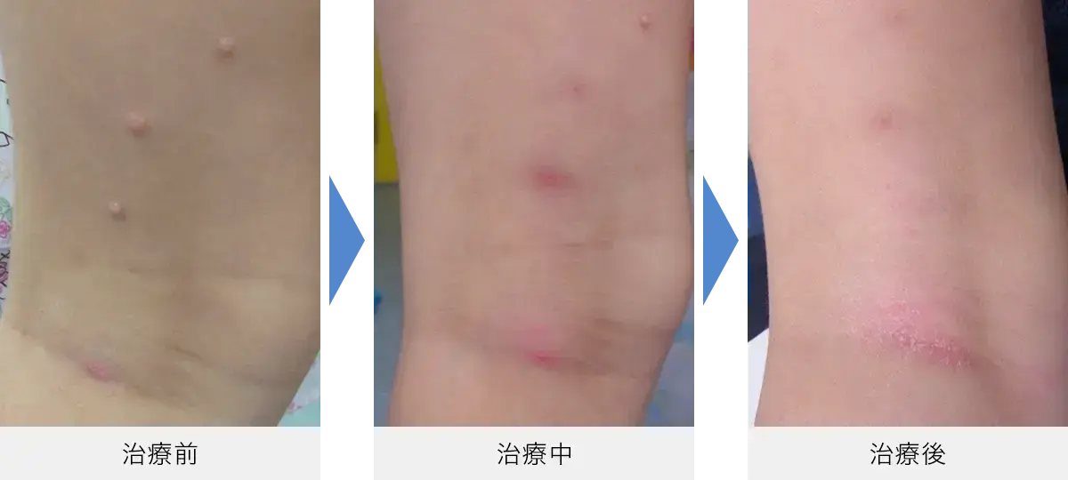 からだのケア 3 幼児期の肌子育てに役立つ情報満載 すくコムNHKエデュケーショナル