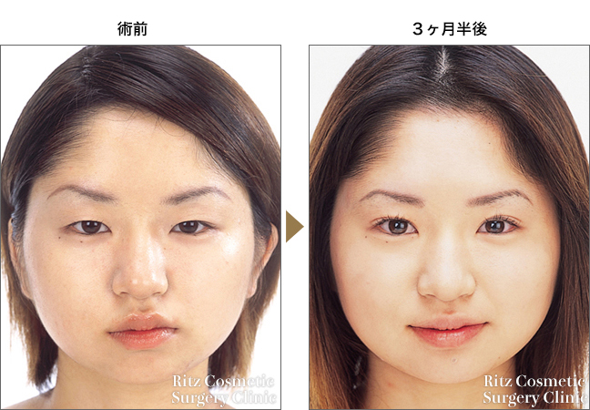 メイクレッスン ～腫れぼったいまぶたが気になる方のカラーアイシャドウ～ - 40代をもっとキレイに