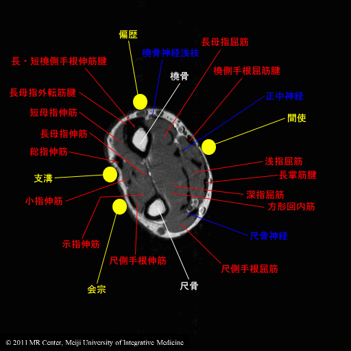 橈骨神経高位麻痺と低位麻痺 回外筋症候群- やまだカイロプラクティック・鍼灸院ホーム ページ