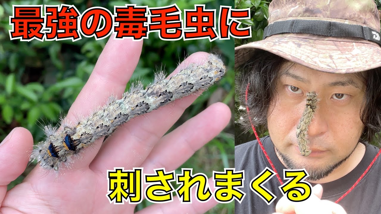 毛虫に刺された、その後状況悪化！！吉田労務管理事務所公式ブログ