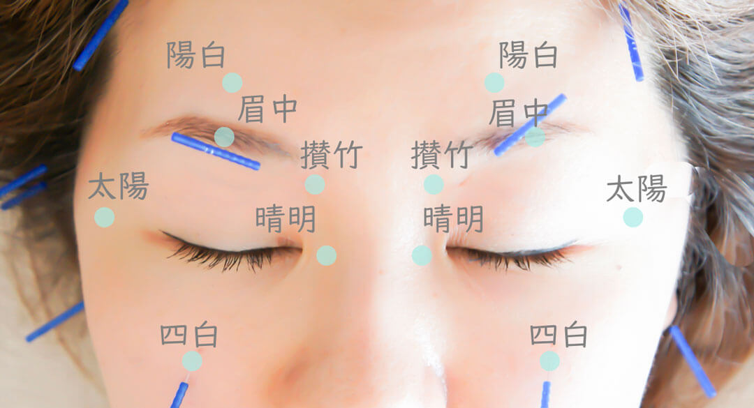 冬に多い「疲れ目」に効く3つのツボ - ウェザーニュース