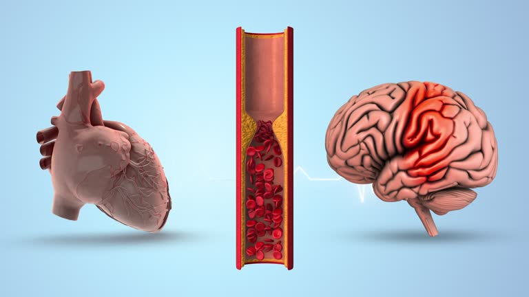 脳梗塞脳外科医 川堀真人のホームページ