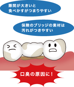 歯科技工のプロが教える 口臭改善にはデンタルフロスがおすすめ！臭い原因や正しい使い方を徹底解説！ - 歯科技工所株式会社シケン コラム
