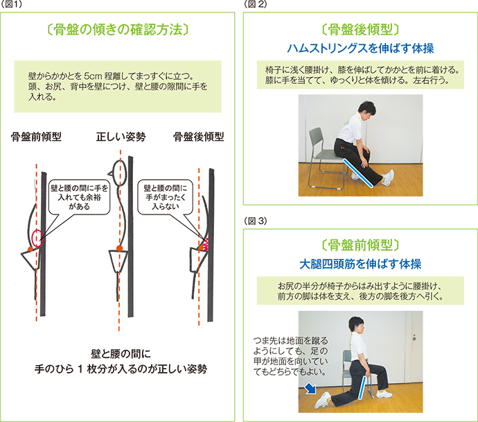 骨盤前傾を引き起こす筋肉は？原因と改善のためのトレーニングを解説