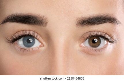 犬 虹彩異色症 ヘテロクロミア とは原因・種類・健康への影響を徹底解説