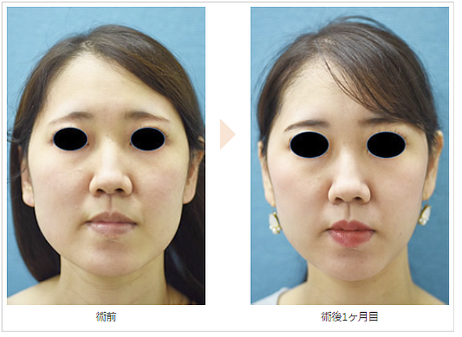 顔ちっさ」「目の錯覚!?」 吉瀬美智子、手の大きさを主張するも小顔っぷりに注目が集まってしまう 1 2ねとらぼ