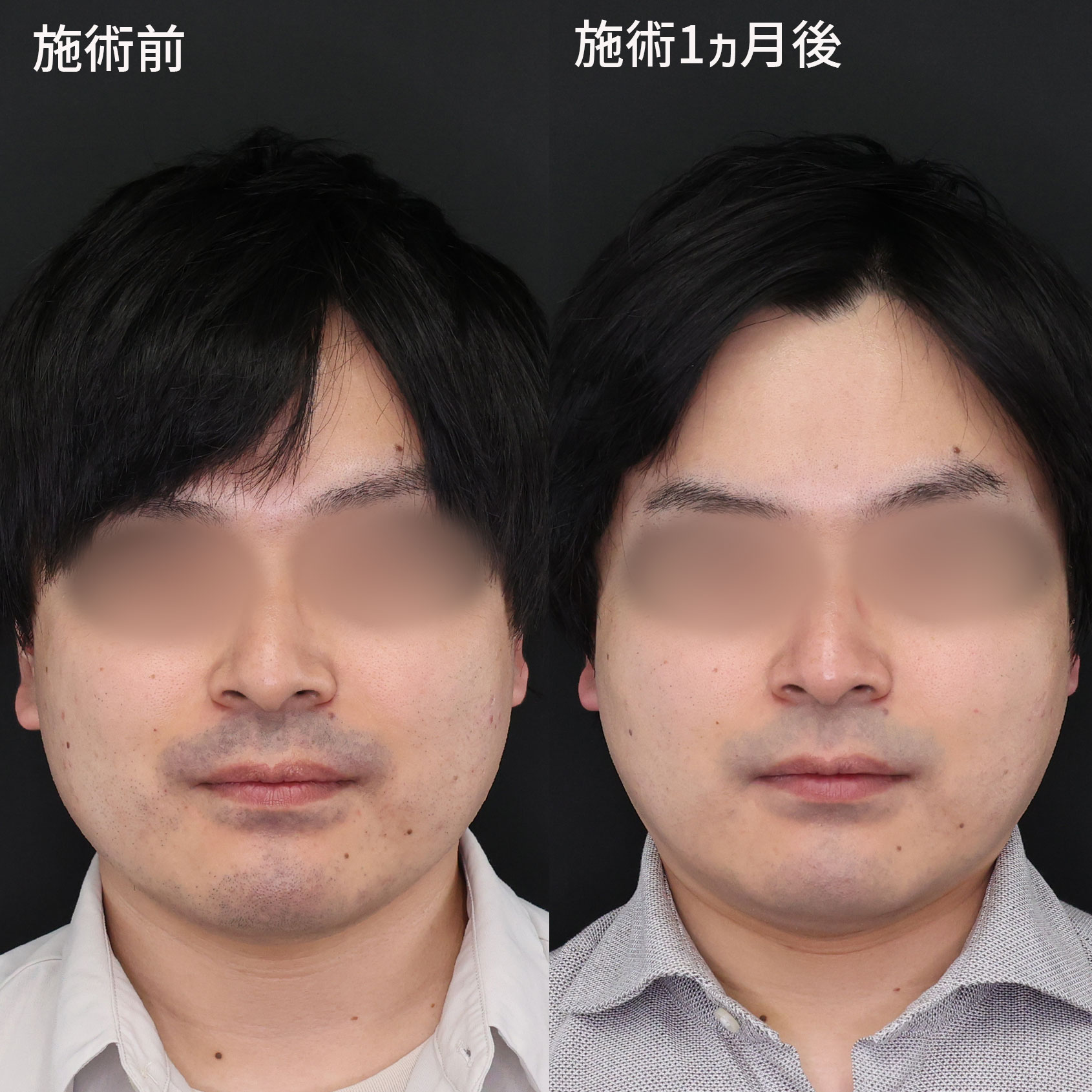 美容師メンズ縮毛矯正関西で1番上手い人 加藤敦貴 かとうあつき - 大阪府大阪市西区北堀江1-2-10STEKiNA