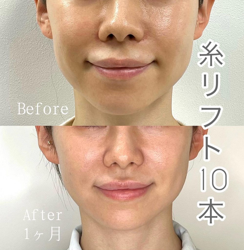 整形美女 成人式で写真を撮られたくなかった 頭の先から足まで整形した女性がたどり着いた答え「結局は顔じゃない」オリコンニュース ORICONNEWS