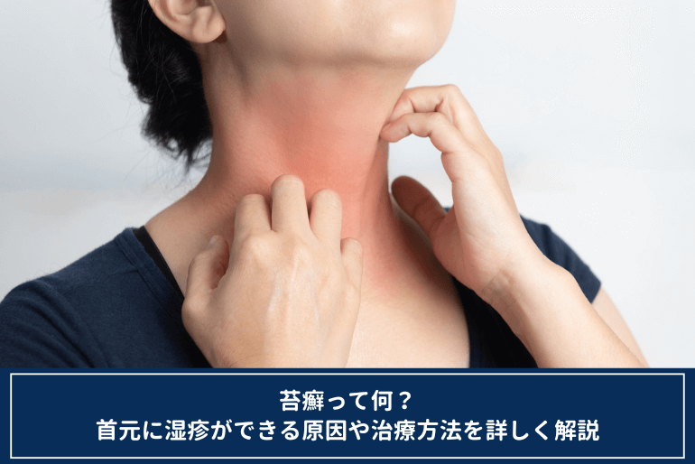 虫刺され高田馬場皮膚科・形成外科