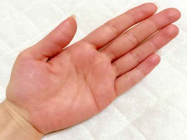 砂かぶれ様皮膚炎子どものホームケアの基礎