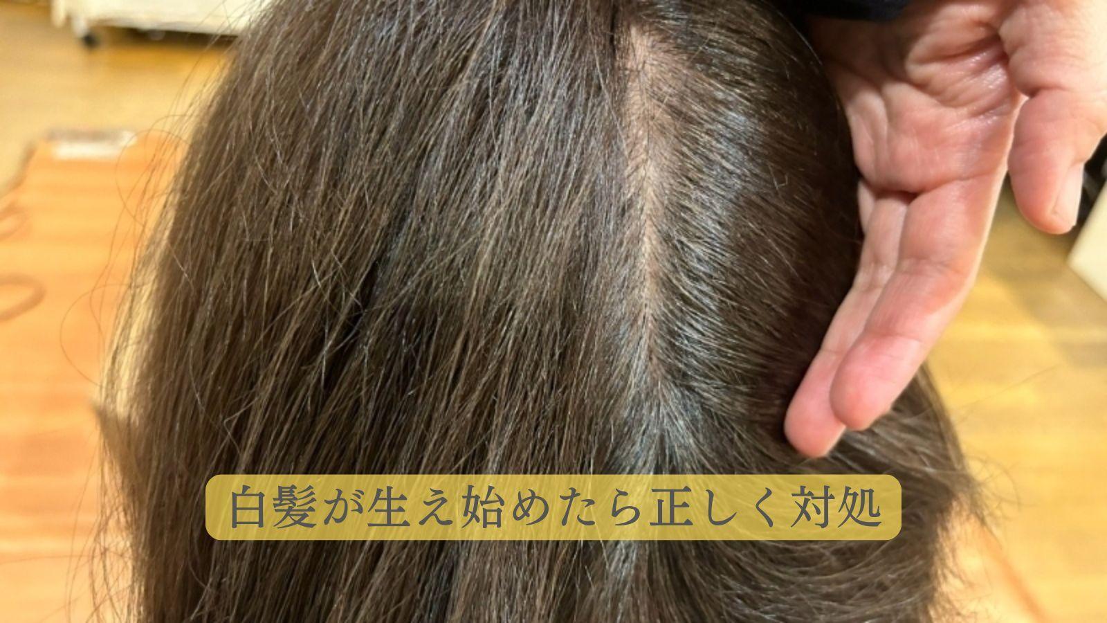 白髪は何歳から生えるのか？平均年齢をご紹介します！ ひでよし 長崎弘幸- エキスパート - Yahoo!ニュース