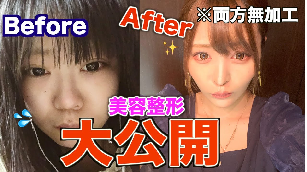 松島萌子 大食いYouTube は鼻と涙袋を整形？wikiに体重は？ 大食い女王決定戦2018