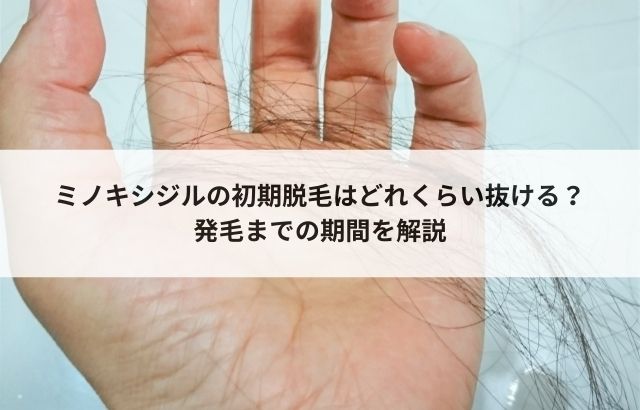 医師監修 ミノキシジルによる初期脱毛はいつから？どのくらいの期間起こる？対策方法も徹底解説