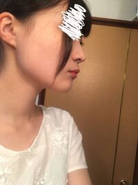 生まれつきの下膨れ顔を小顔に改善する方法輪郭形成・小顔整形 コラム池袋の小顔整形・顔痩せ・輪郭整形みずほクリニック