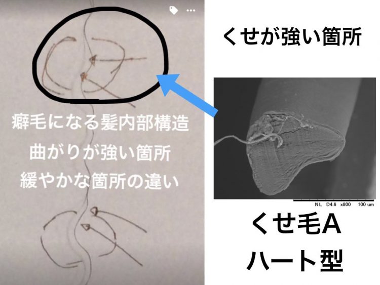 毛穴の構造 角栓 断面図のイラスト素材24663381- PIXTA